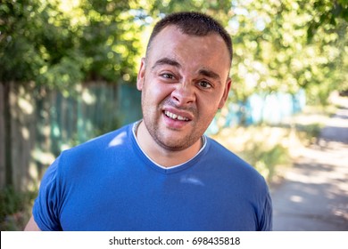 Young Man In A Blue T-shirt With A Chipped Tooth