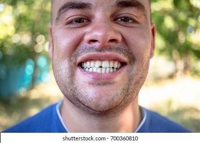 Young Man In A Blue T-shirt With A Chipped Tooth