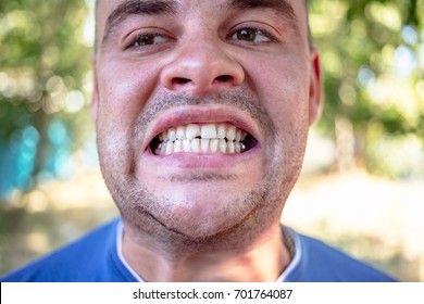 Young Man In A Blue T-shirt With A Chipped Tooth