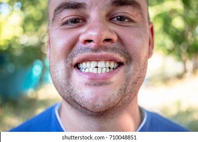 Young Man In A Blue T-shirt With A Chipped Tooth