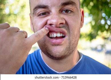 Young Man In A Blue T-shirt With A Chipped Tooth