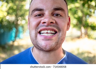 Young Man In A Blue T-shirt With A Chipped Tooth