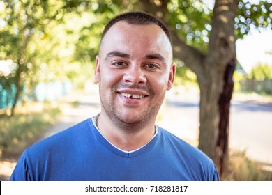 Young Man In A Blue T-shirt With A Chipped Tooth