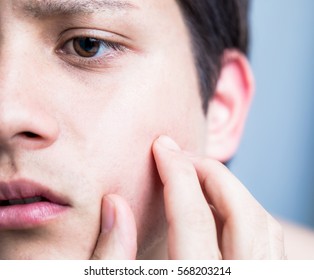 Young Man Checking His Skin Of Face