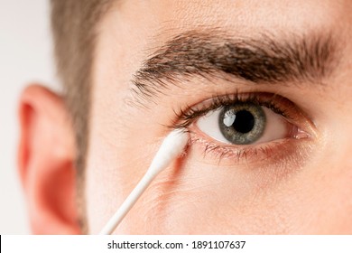 Young man is cleaning his eye with a cotton swab