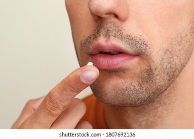 Young Man With Cold Sore Applying Cream On Lips Against Light Background, Closeup