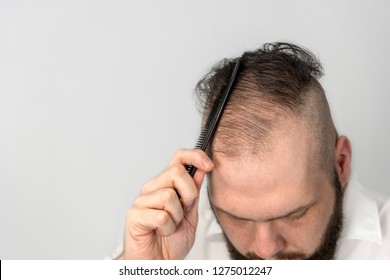 Young Man Combs His Thinning Hair