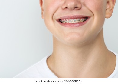 Young Man With Dental Braces On Grey Background