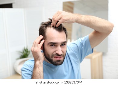 Young Man With Hair Loss Problem Indoors