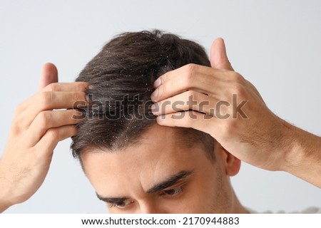 Young man with problem of dandruff on light background, closeup Foto stock © 