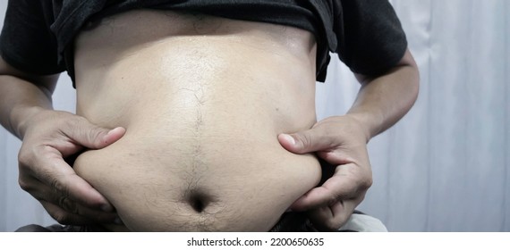 fat stomach skinny body
