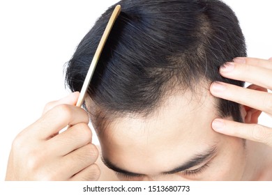 Men Hair Problems Images Stock Photos Vectors Shutterstock