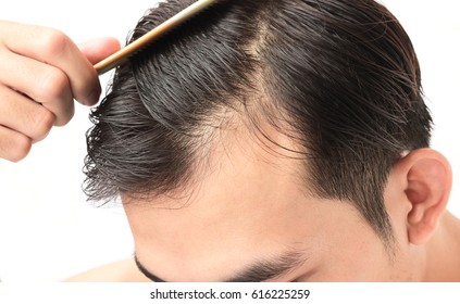 Imagenes Fotos De Stock Y Vectores Sobre Problems Hair Man