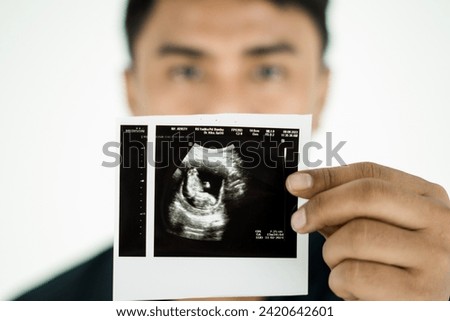Young Man show ultrasound image of his baby, focus on ultrasound image