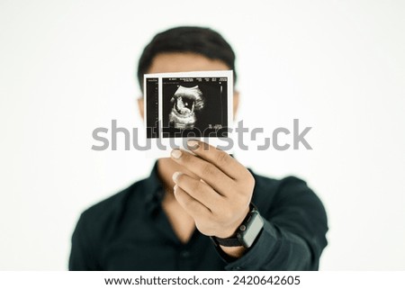 Young Man show ultrasound image of his baby, focus on ultrasound image
