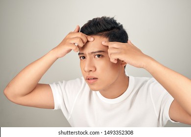 Young Man Struggling With Acne On His Face Caring For His Skin Pushes Acne