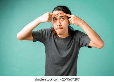 Young Man Struggling With Acne On His Face Caring For His Skin Pushes Acne