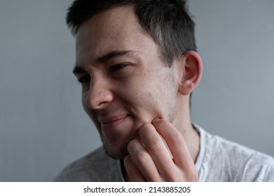 Young Man Struggling With Acne On His Face Caring For His Skin Pushes Acne