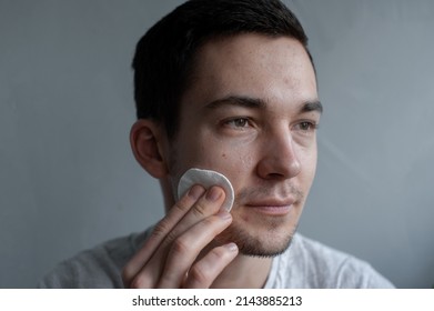 Young Man Struggling With Acne On His Face Caring For His Skin Pushes Acne