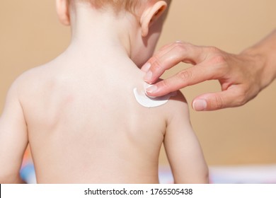 Young Mother Hand Applying Sunscreen Lotion On Baby Shoulder. Skin Protection. Safety Sunbathing In Hot Day At Beach. Back View. Closeup.