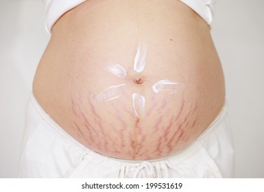 Young pregnant woman applying moisturizer on her belly.