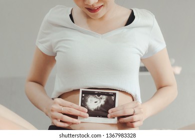 Baby at 4 weeks pregnant