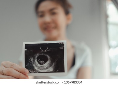 Ultrasound pregnant 8 weeks Symptoms, Weight