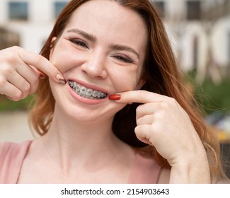 Young Red-haired Woman With Braces On Her Teeth Point To A Smile Outdoors In Summer