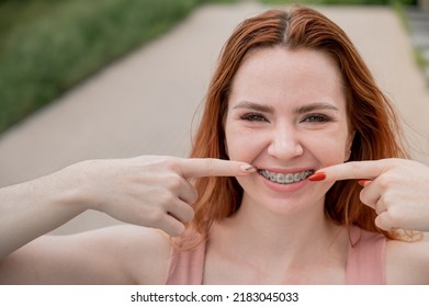 Young Red-haired Woman With Braces On Her Teeth Point To A Smile Outdoors In Summer