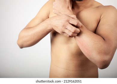 Young Shirtless Male Itching His Forearm Skin Suffering From Skin Diseases, Skin Allergy