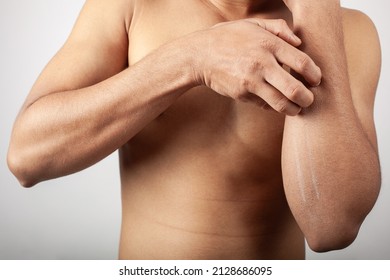 Young Shirtless Male Scratching His Forearm Skin Suffering From Skin Diseases, Skin Allergy, Skin Rashes