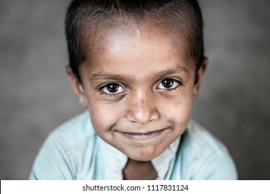 a young sick child suffering from cancer but still smiling