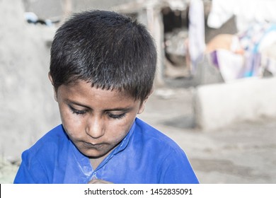 A Young Sick Child Suffering From Cancer And Looks Very Sad