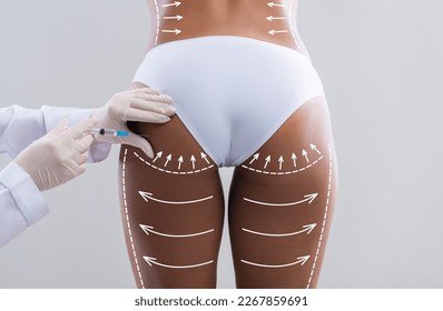 Young slim black woman in white bikini with abstract lines gets injection from beautician in hips isolated on gray wall background, studio, back. Beauty care, body shaping, medical care and buttocks - Shutterstock ID 2267859691