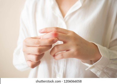 Young female​ suffering from hand and finger joint pain​ with​ redness.​ Cause of pain include rheumatoid arthritis, carpal tunnel syndrome, trigger finger or gout. Health care and medical concept.