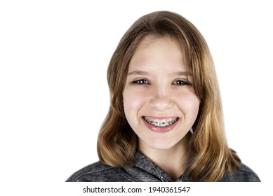 Young Teen Girl With Braces On Her Teeth Isolated On A White Background, The Girl Is Happy Because She Will Correct A Bad Bite, Malocclusion And Her Teeth Will Be Aligned