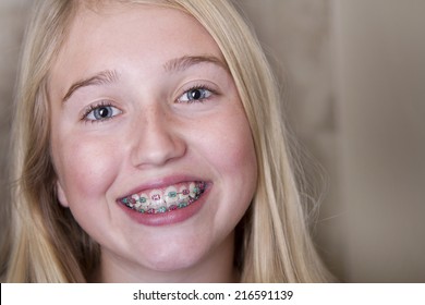 Young teen girl with braces on her teeth