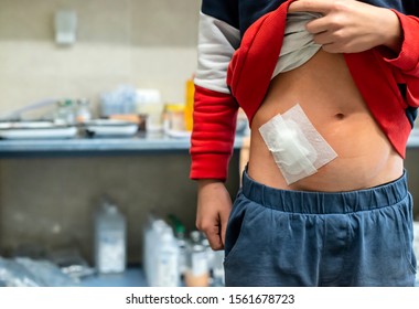 Young teenage boy in hospital. Child with cut wound in medical cabinet in hospital. Kid shows belly wound. Concept for wound from surgery. 