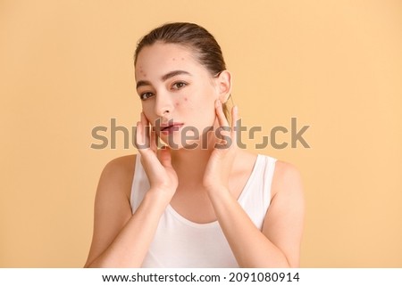 Young woman with acne problem on color background