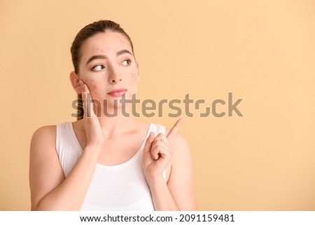 Young woman with acne problem on color background
