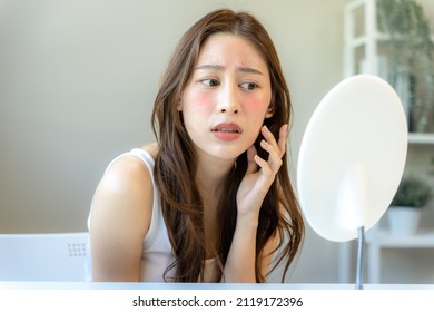 Young woman asian are worried about faces Dermatology and allergic to steroids in cosmetics. sensitive skin,red face from sunburn, acne,allergic to chemicals,rash on face. skin problems and beauty - Shutterstock ID 2119172396
