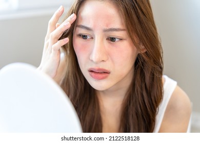 Young woman asian are worried about faces Dermatology and allergic to steroids in cosmetics. sensitive skin,red face from sunburn, acne,allergic to chemicals,rash on face. skin problems and beauty - Shutterstock ID 2122518128