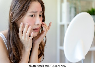 Young woman asian are worried about faces Dermatology and allergic to steroids in cosmetics. sensitive skin,red face from sunburn, acne,allergic to chemicals,rash on face. skin problems and beauty - Shutterstock ID 2136757509