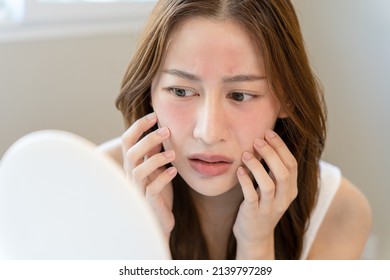 Young woman asian are worried about faces Dermatology and allergic to steroids in cosmetics. sensitive skin,red face from sunburn, acne,allergic to chemicals,rash on face. skin problems and beauty