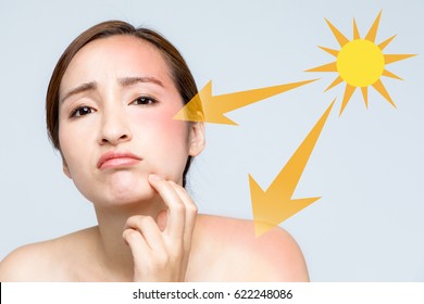 Young Woman With A Bad Sunburn On Her Face