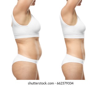 Young Woman Before And After Weight Loss On White Background