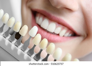 Young woman choosing color of teeth at dentist, closeup
