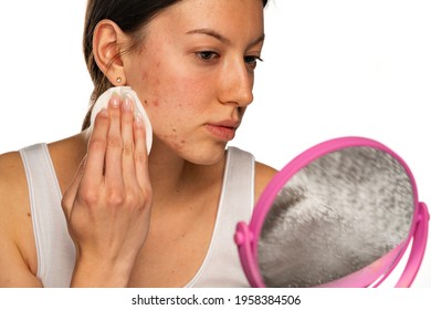 a young woman cleans her face with problematic skin on a white background