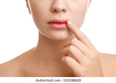 Young Woman With Cold Sore Touching Lips Against White Background, Closeup