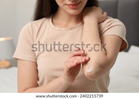 Young woman with dry skin applying cream onto her elbow indoors, closeup